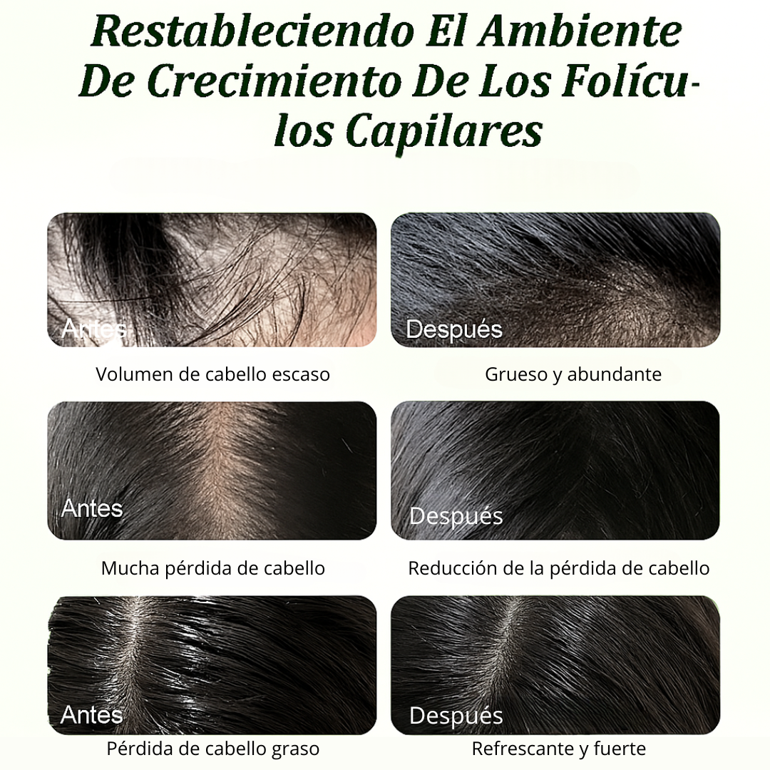 VellaFem- Champú de Batana para Crecimiento y Nutrición del Cabello™️