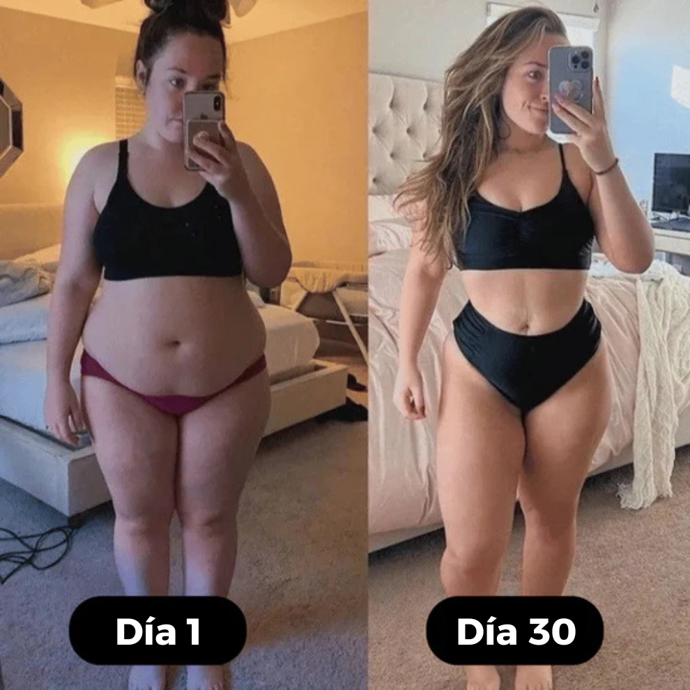 VellaFem-Masajeador AntiCelulitis™️