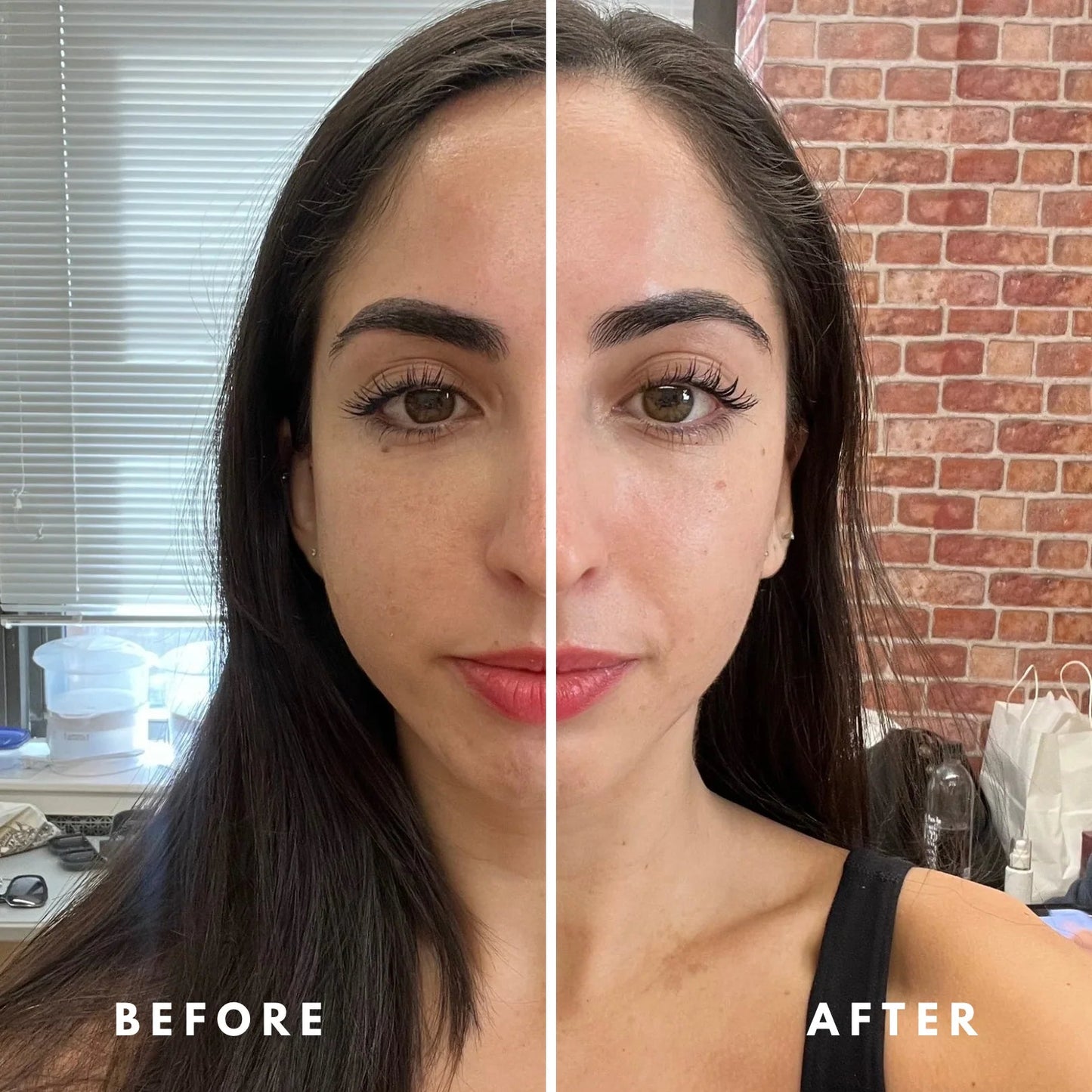 VellaFem-Cepillo Masajeador Linfático Facial™️