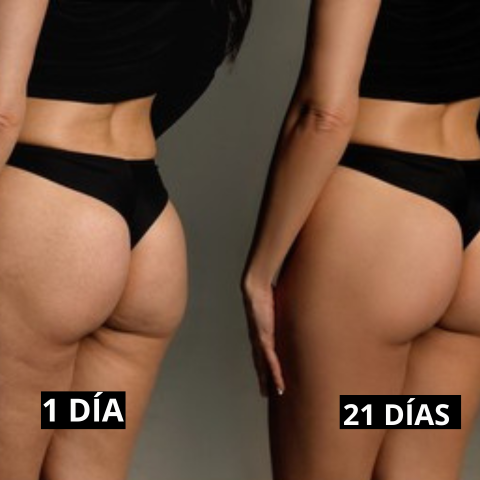 VellaFem-Masajeador AntiCelulitis™️