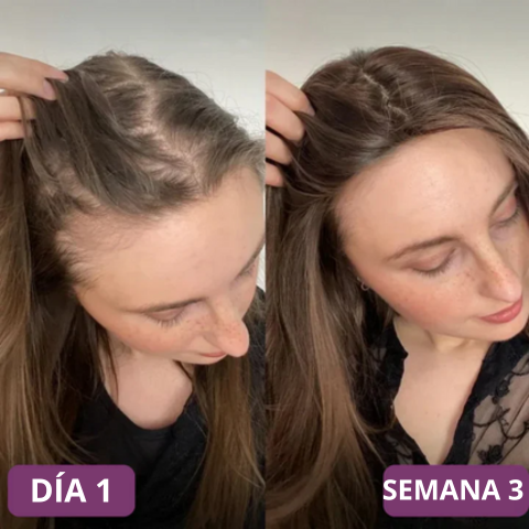VellaFem-Gominolas Crece Pelo™️