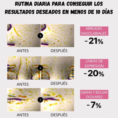 VellaFem-Parches Elimina Ojeras™️