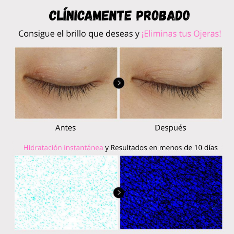 VellaFem-Parches Elimina Ojeras™️