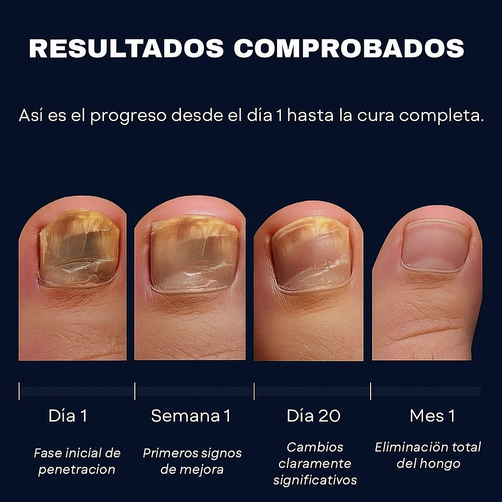 VellaFem-Lápiz Antihongos Uñas™️