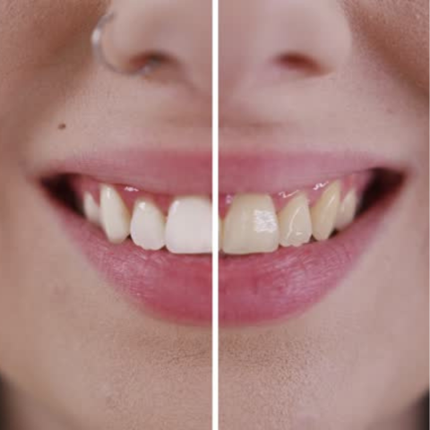 VellaFem-Nobs Pasta de Dientes™️